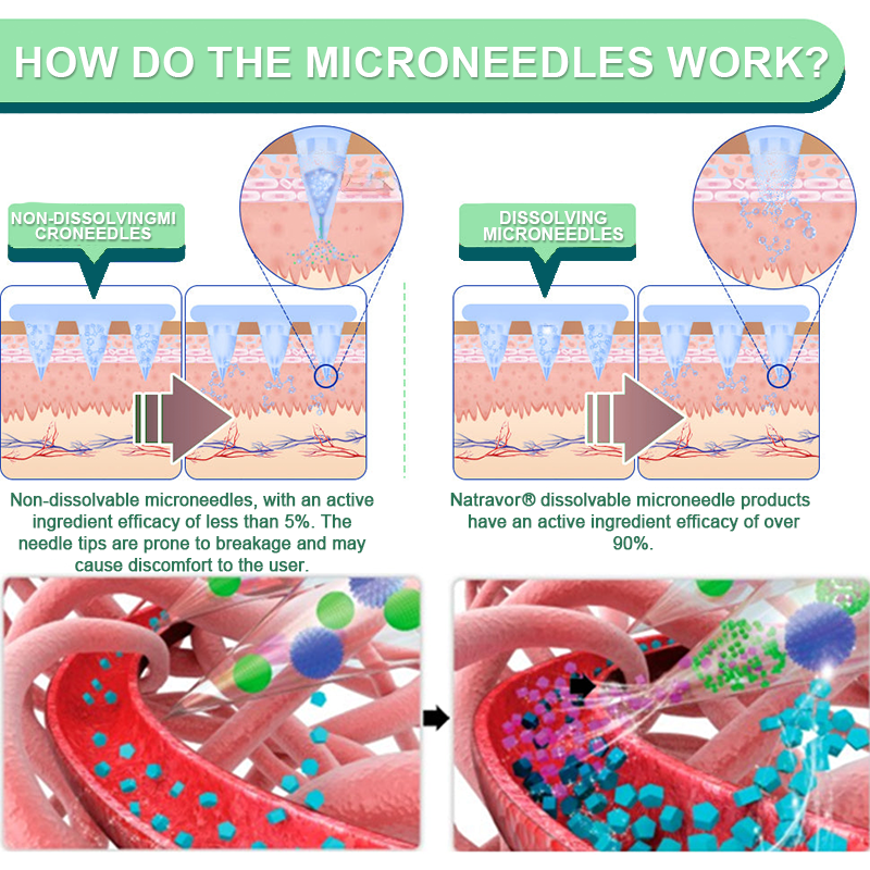 ❤️【Letzter Tagesangebot 60 % RABATT】Natravor® NIDDK-Tirzepatide Abnehmen & Gesundheit NANO MICRONEEDLE PATCH👨‍⚕️（Keine Schmerzen, 24/7 Freisetzung | Verlieren Sie SCHNELL 20 Pfund | 90 % Zuckerabfall | ）