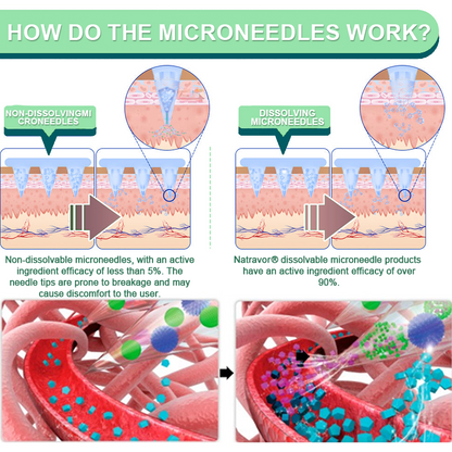 ❤️【Letzter Tagesangebot 60 % RABATT】Natravor® NIDDK-Tirzepatide Abnehmen & Gesundheit NANO MICRONEEDLE PATCH👨‍⚕️（Keine Schmerzen, 24/7 Freisetzung | Verlieren Sie SCHNELL 20 Pfund | 90 % Zuckerabfall | ）